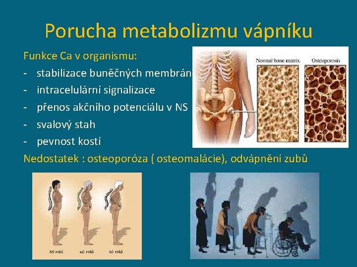 Porucha metabolizmu vápníku Funkce Ca v organismu: - stabilizace buněčných membrán - intracelulární signalizace