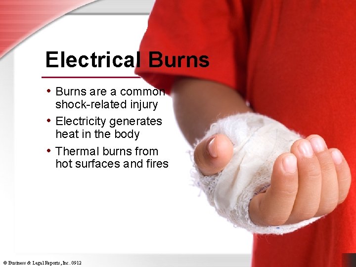 Electrical Burns • Burns are a common shock-related injury • Electricity generates heat in