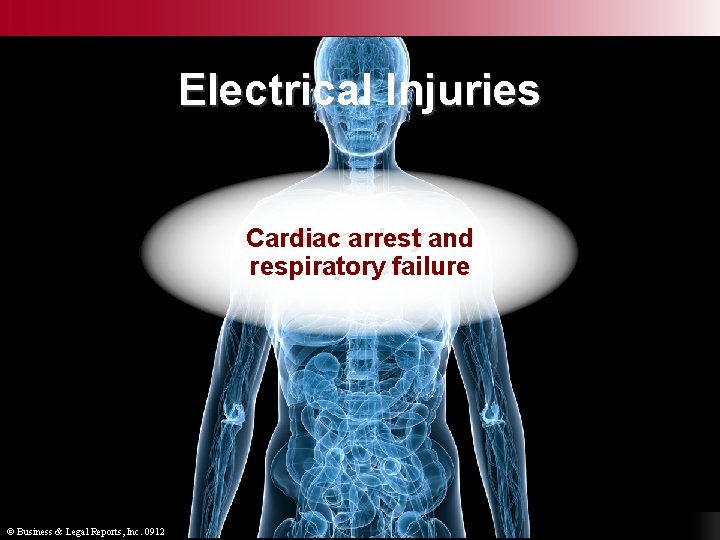 Electrical Injuries Muscle, Cardiac Secondary nerve, arrest and Thermal Burns burns tissue respiratory injuries
