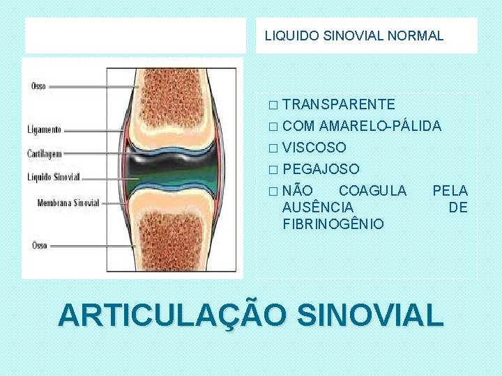 LIQUIDO SINOVIAL NORMAL � TRANSPARENTE � COM AMARELO-PÁLIDA � VISCOSO � PEGAJOSO � NÃO