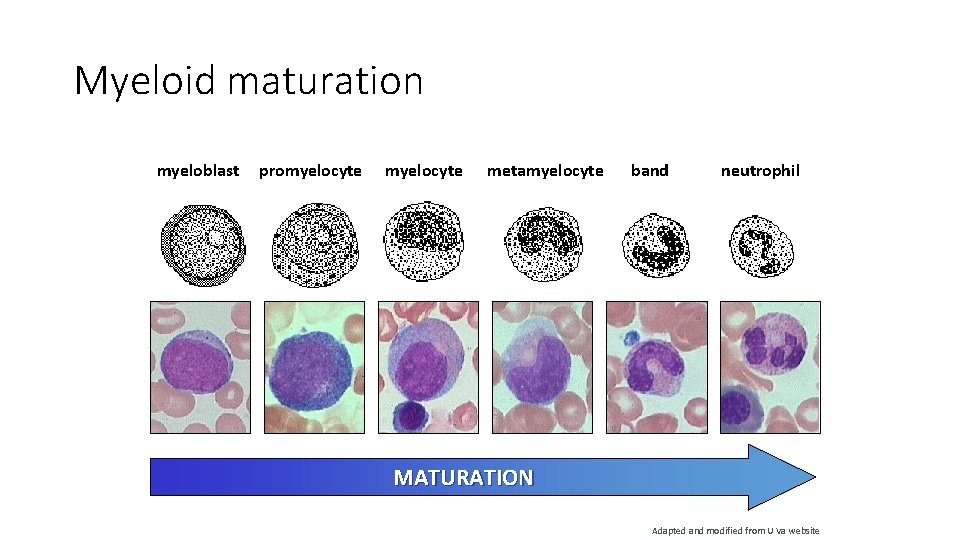 Myeloid maturation myeloblast promyelocyte metamyelocyte band neutrophil MATURATION Adapted and modified from U Va