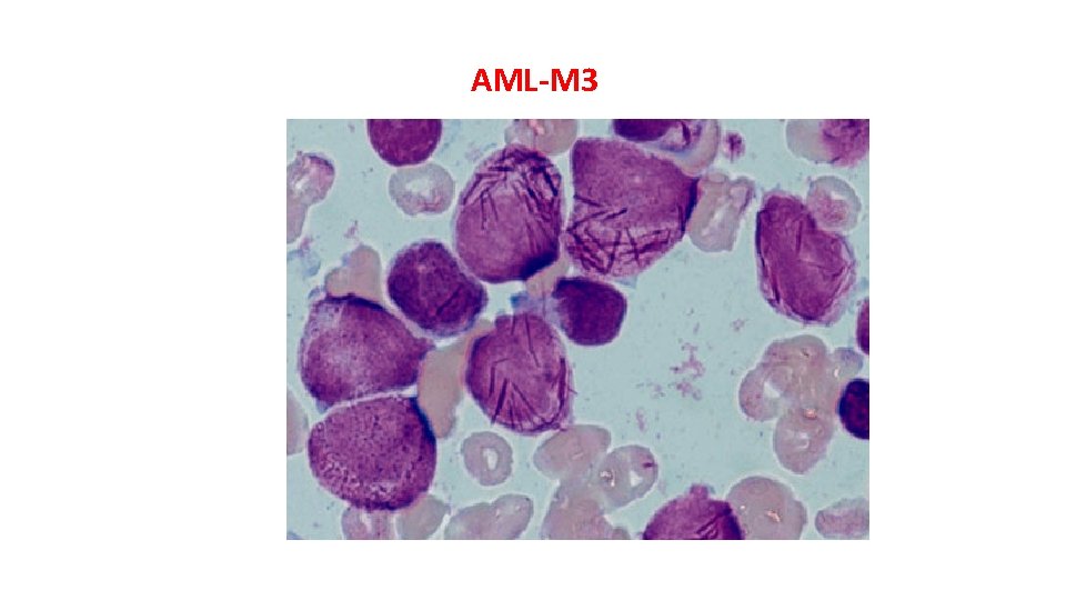 AML-M 3 