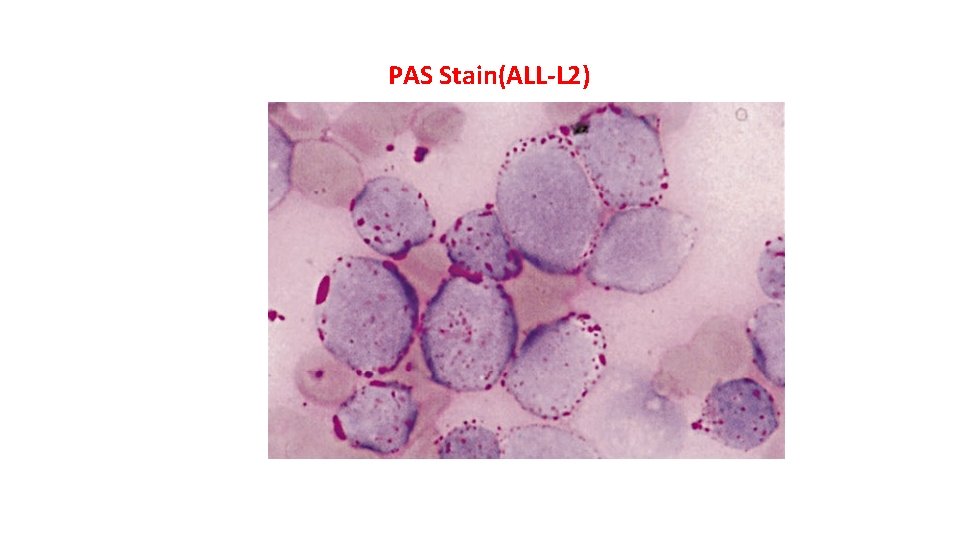 PAS Stain(ALL-L 2) 