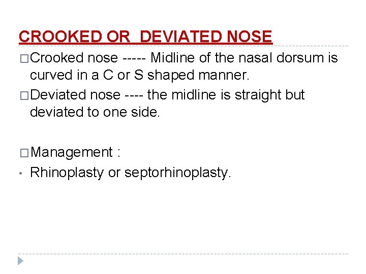 CROOKED OR DEVIATED NOSE �Crooked nose ----- Midline of the nasal dorsum is curved