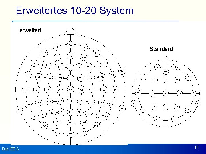 Erweitertes 10 -20 System erweitert Standard Das EEG 11 