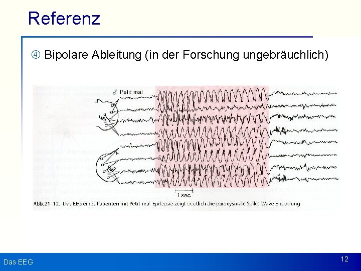 Referenz Bipolare Ableitung (in der Forschung ungebräuchlich) Das EEG 12 