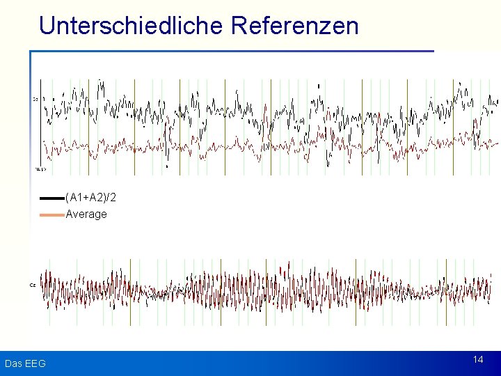 Unterschiedliche Referenzen (A 1+A 2)/2 Average Das EEG 14 