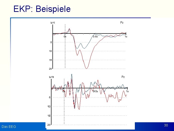 EKP: Beispiele Das EEG 30 