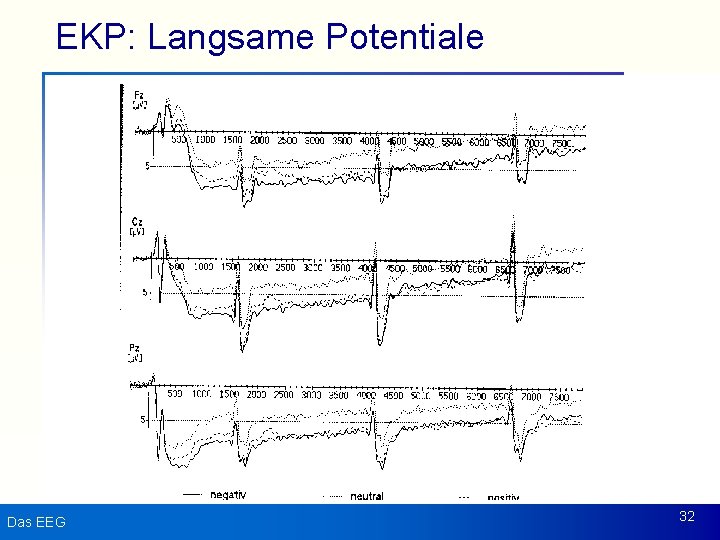 EKP: Langsame Potentiale Das EEG 32 