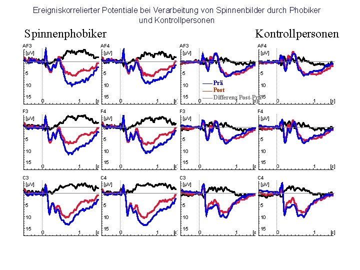Ereigniskorrelierter Potentiale bei Verarbeitung von Spinnenbilder durch Phobiker und Kontrollpersonen Spinnenphobiker AF 3 [µV]