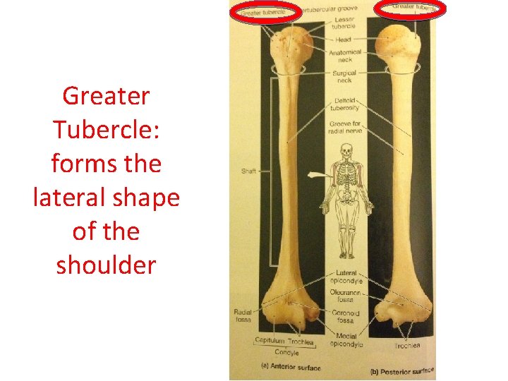 Greater Tubercle: forms the lateral shape of the shoulder  Greater Tubercle: forms the lateral shape of the shoulder