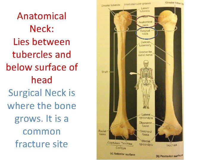 Anatomical Neck: Lies between tubercles and below surface of head Surgical Neck is where