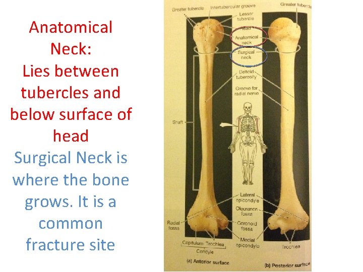 Anatomical Neck: Lies between tubercles and below surface of head Surgical Neck is where Anatomical Neck: Lies between tubercles and below surface of head Surgical Neck is where