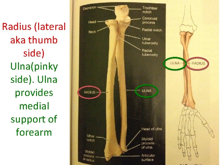 Radius (lateral aka thumb side) Ulna(pinky side). Ulna provides medial support of forearm  Radius (lateral aka thumb side) Ulna(pinky side). Ulna provides medial support of forearm