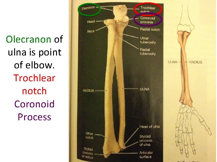 Olecranon of ulna is point of elbow. Trochlear notch Coronoid Process  Olecranon of ulna is point of elbow. Trochlear notch Coronoid Process