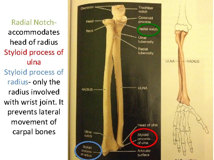 Radial Notchaccommodates head of radius Styloid process of ulna Styloid process of radius- only Radial Notchaccommodates head of radius Styloid process of ulna Styloid process of radius- only