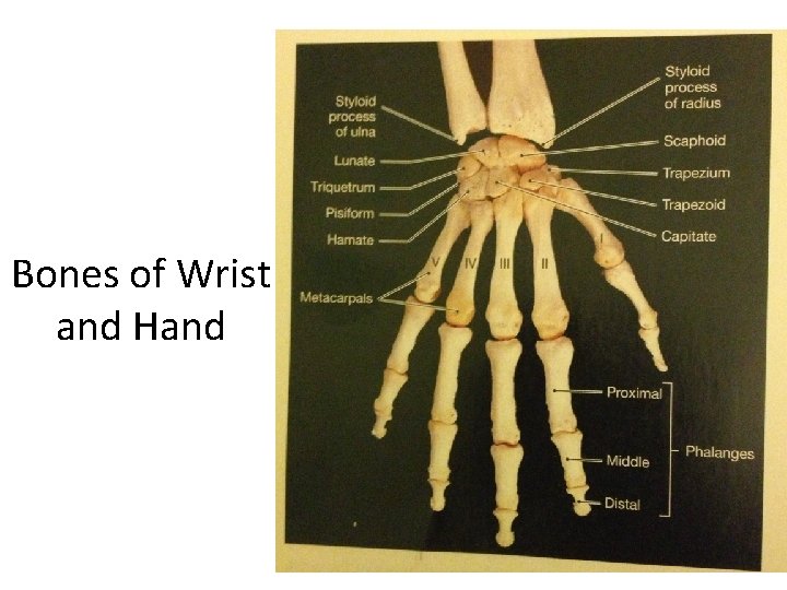 Bones of Wrist and Hand  Bones of Wrist and Hand