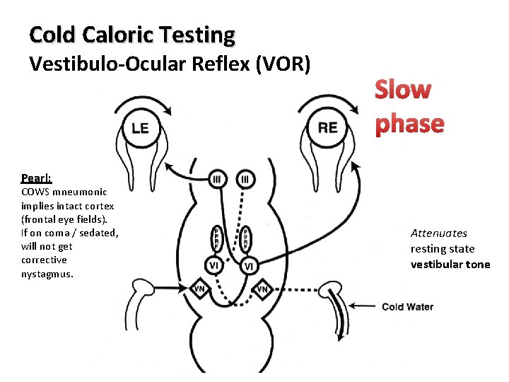 Cold Caloric Testing Vestibulo-Ocular Reflex (VOR) Slow phase Pearl: COWS mneumonic implies intact cortex