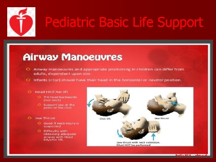 Pediatric Basic Life Support Pedia BLS ---rbt 2016 --- 