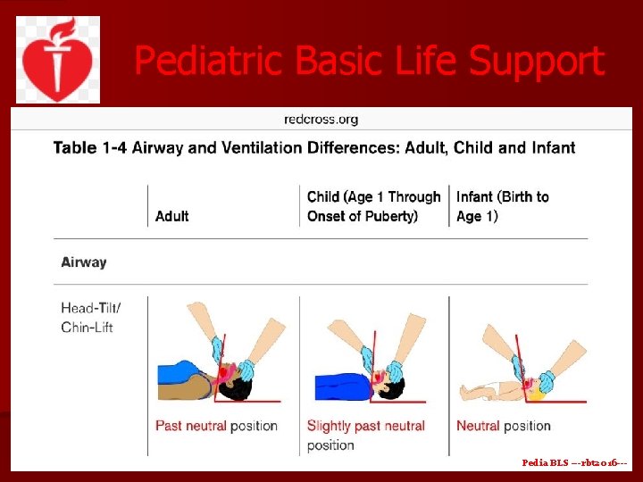 Pediatric Basic Life Support Pedia BLS ---rbt 2016 --- 