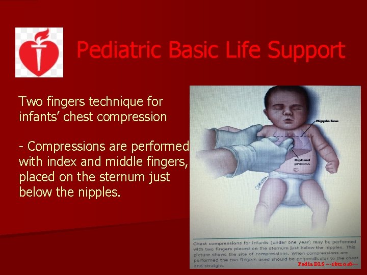 Pediatric Basic Life Support Two fingers technique for infants’ chest compression - Compressions are