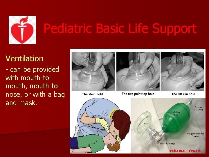 Pediatric Basic Life Support Ventilation - can be provided with mouth-tomouth, mouth-tonose, or with