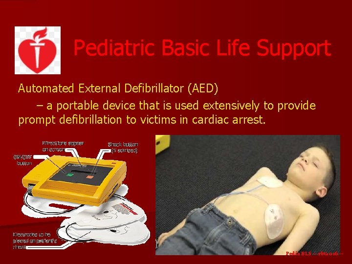 Pediatric Basic Life Support Automated External Defibrillator (AED) – a portable device that is