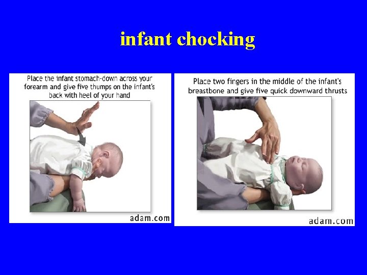 infant chocking infant chocking