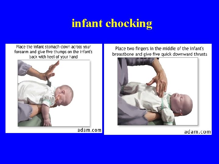 infant chocking 