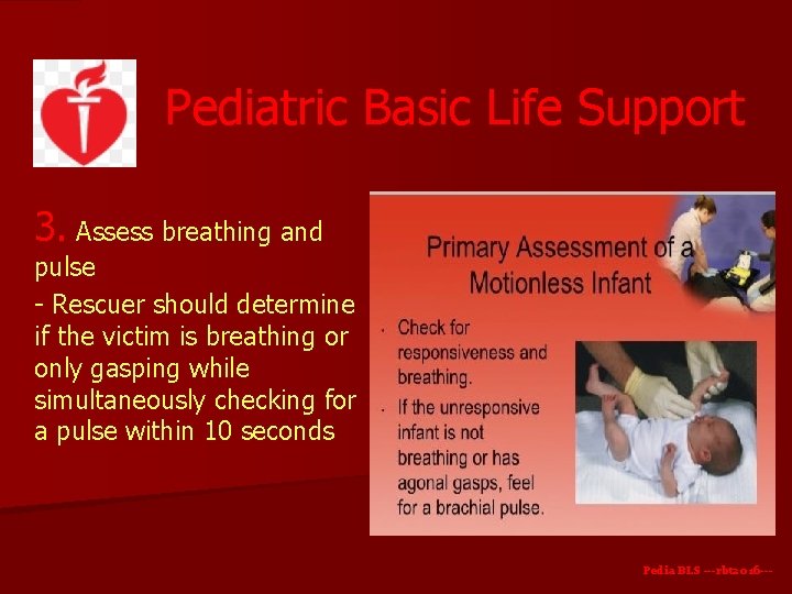 Pediatric Basic Life Support 3. Assess breathing and pulse - Rescuer should determine if