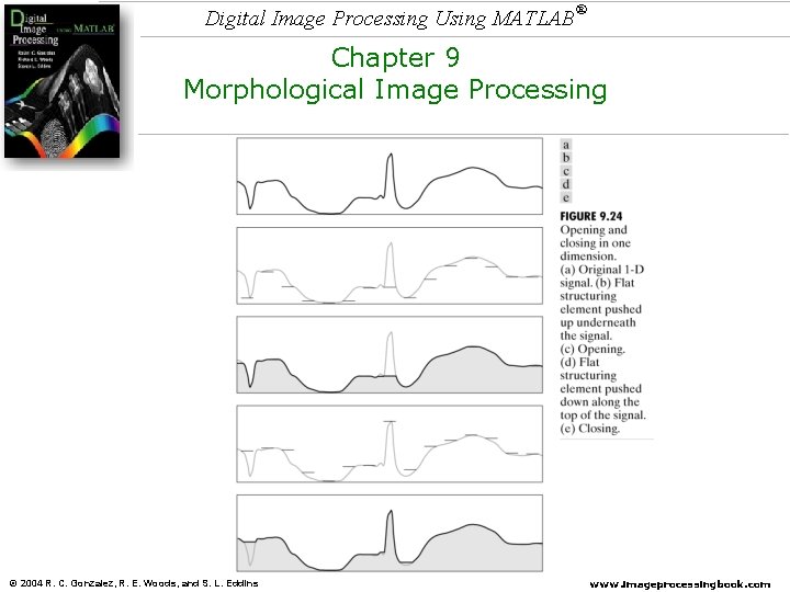 Digital Image Processing Using MATLAB ® Chapter 9 Morphological Image Processing © 2004 R. Digital Image Processing Using MATLAB ® Chapter 9 Morphological Image Processing © 2004 R.