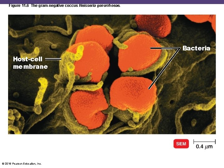 Figure 11. 6 The gram-negative coccus Neisseria gonorrhoeae. Bacteria Host-cell membrane © 2016 Pearson