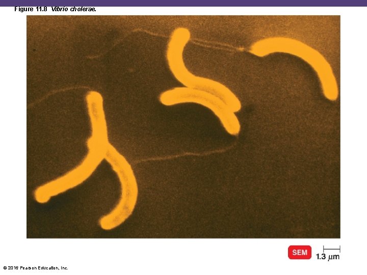 Figure 11. 8 Vibrio cholerae. © 2016 Pearson Education, Inc. 
