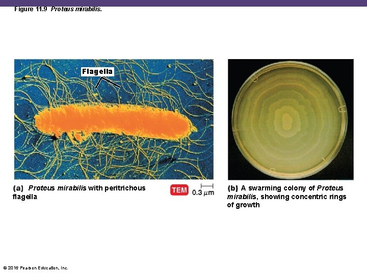 Figure 11. 9 Proteus mirabilis. Flagella Proteus mirabilis with peritrichous flagella © 2016 Pearson