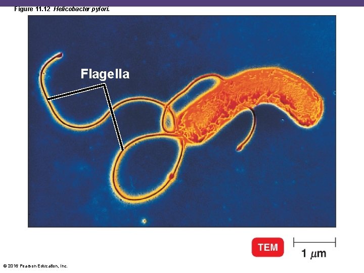 Figure 11. 12 Helicobacter pylori. Flagella © 2016 Pearson Education, Inc. 