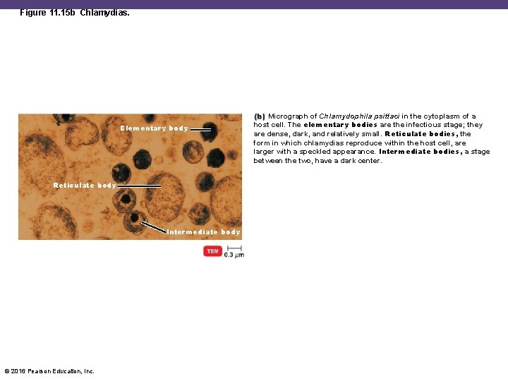 Figure 11. 15 b Chlamydias. Elementary body Reticulate body Intermediate body © 2016 Pearson