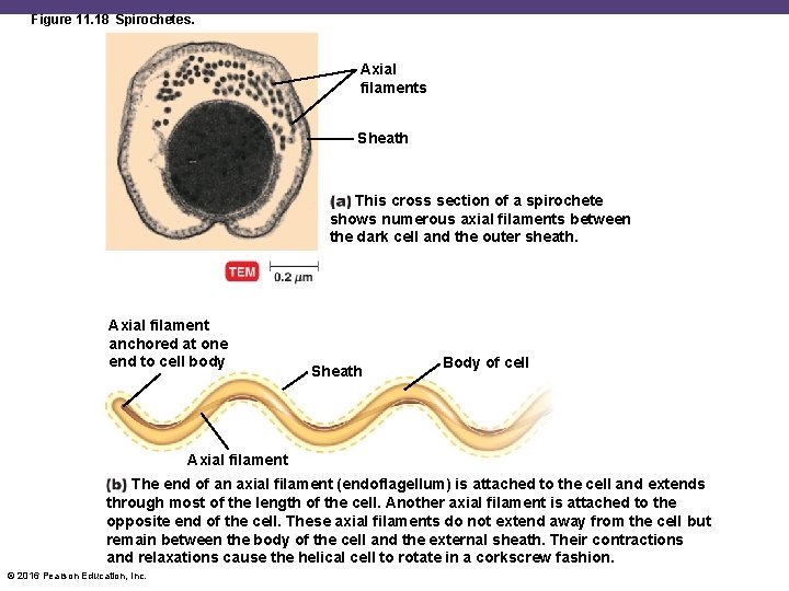Figure 11. 18 Spirochetes. Axial filaments Sheath This cross section of a spirochete shows