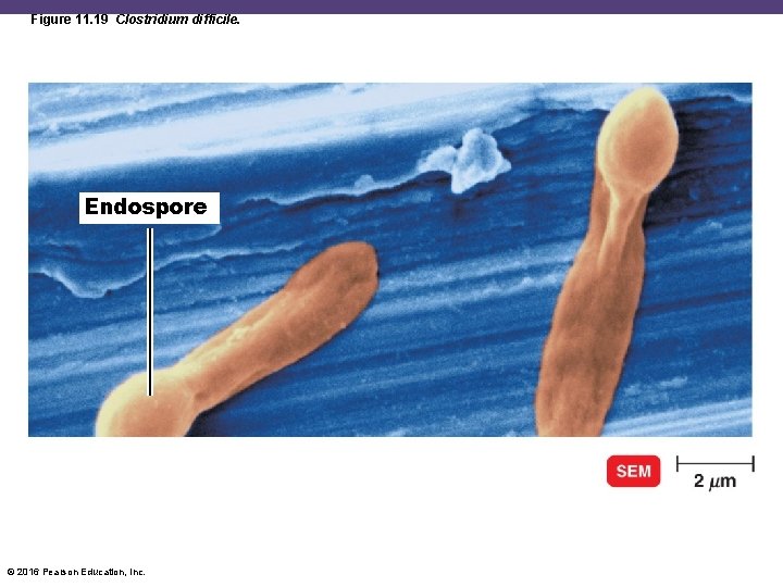 Figure 11. 19 Clostridium difficile. Endospore © 2016 Pearson Education, Inc. 