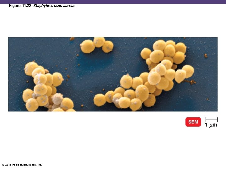 Figure 11. 22 Staphylococcus aureus. © 2016 Pearson Education, Inc. 