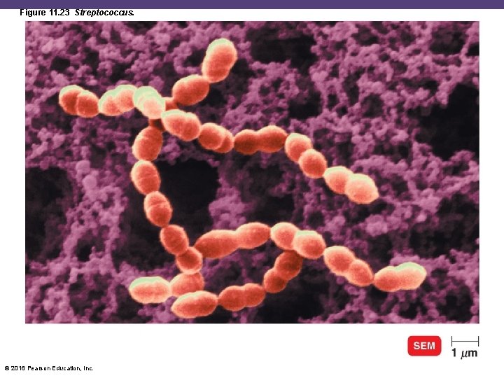 Figure 11. 23 Streptococcus. © 2016 Pearson Education, Inc. 