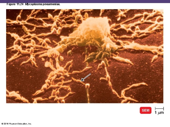 Figure 11. 24 Mycoplasma pneumoniae. © 2016 Pearson Education, Inc. 