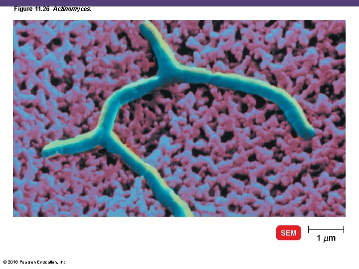 Figure 11. 26 Actinomyces. © 2016 Pearson Education, Inc. 