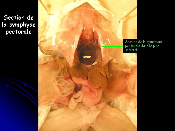 Section de la symphyse pectorale dans le plan sagittal cœur 