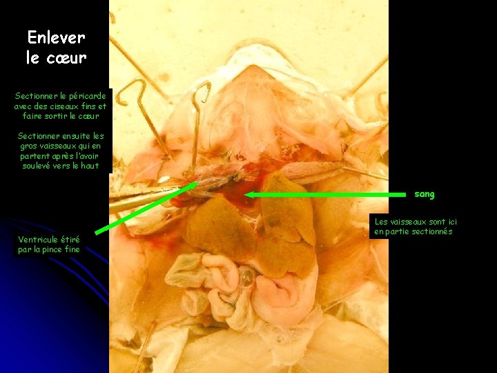 Enlever le cœur Sectionner le péricarde avec des ciseaux fins et faire sortir le