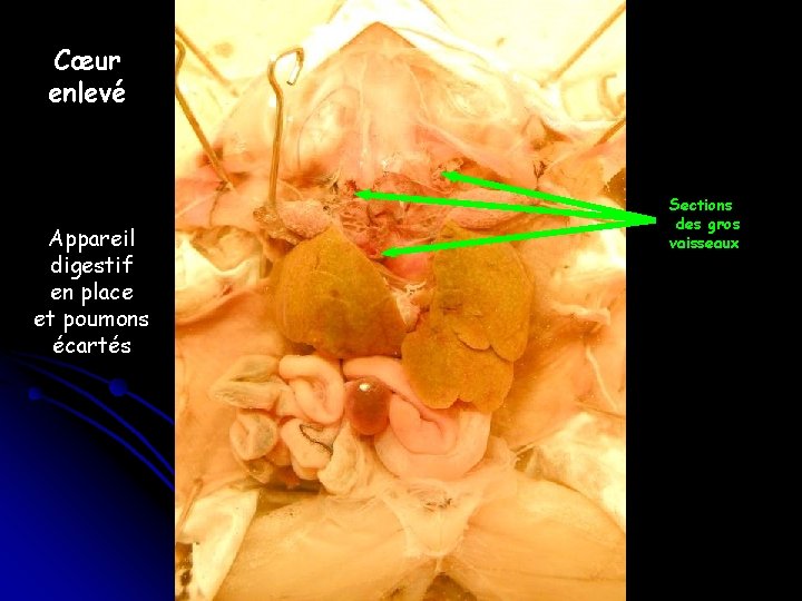 Cœur enlevé Appareil digestif en place et poumons écartés Sections des gros vaisseaux 