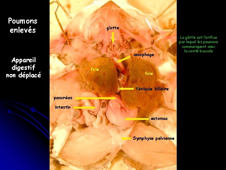 Poumons enlevés glotte œsophage Appareil digestif non déplacé foie Vésicule biliaire pancréas intestin estomac