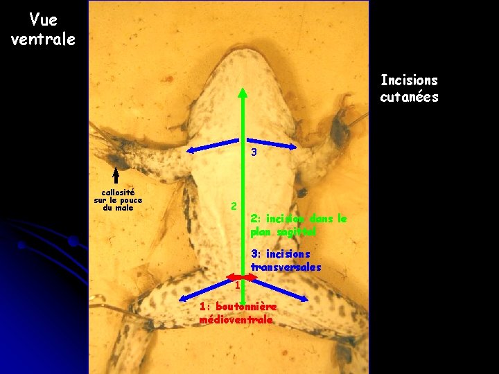 Vue ventrale Incisions cutanées 3 callosité sur le pouce du male 2 2: incision