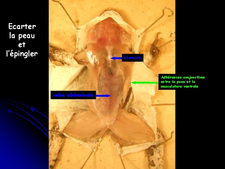 Ecarter la peau et l’épingler sternum Adhérences conjonctives entre la peau et la musculature