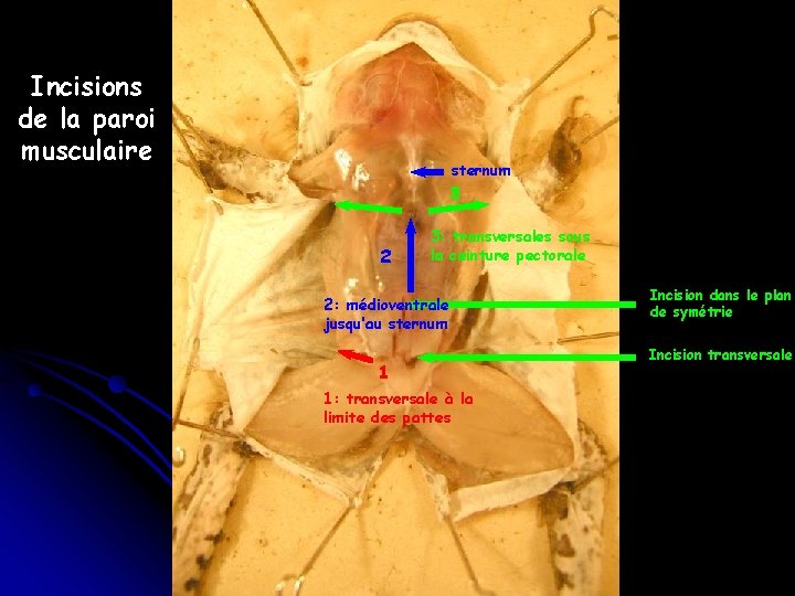 Incisions de la paroi musculaire sternum 3 2 3: transversales sous la ceinture pectorale