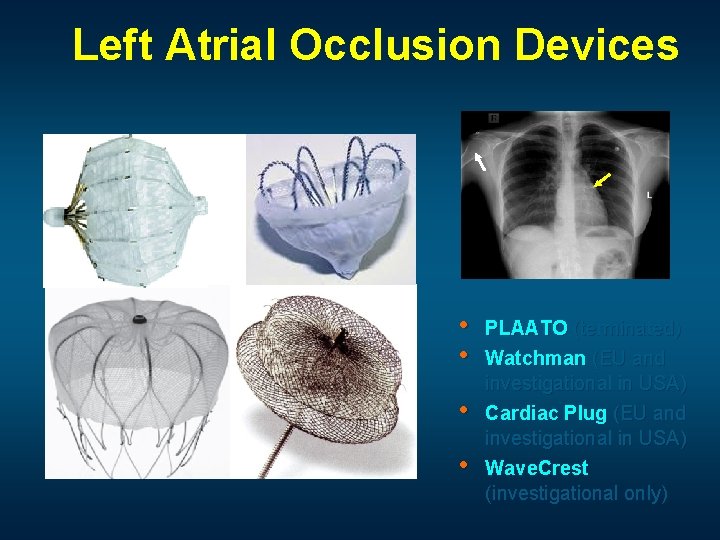 Left Atrial Occlusion Devices • • PLAATO (terminated) Watchman (EU and investigational in USA)